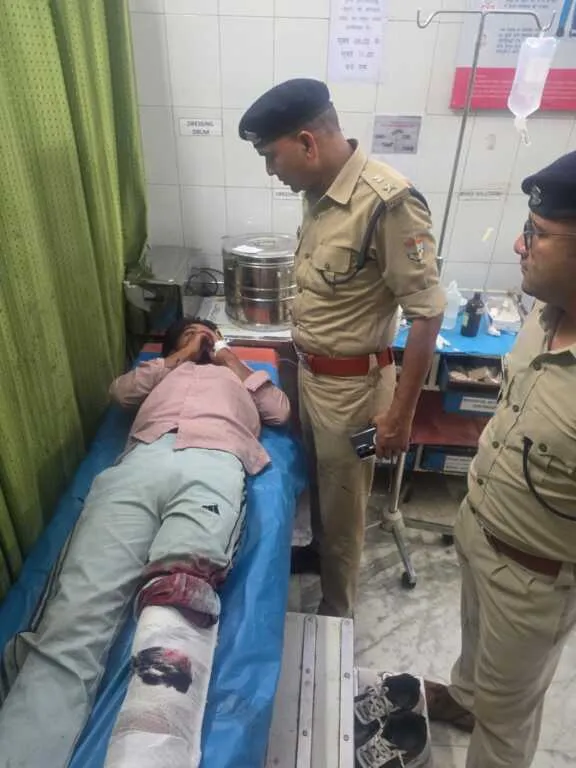 देहरादून : पटेल नगर में पुलिस-बदमाशों के बीच मुठभेड़, एक बदमाश के पैर में लगी गोली